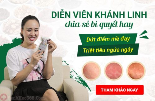 Diễn viên Về nhà đi con Phùng Khánh Linh trải lòng hành trình dứt điểm mề đay mẩn ngứa bằng bài thuốc thảo dược