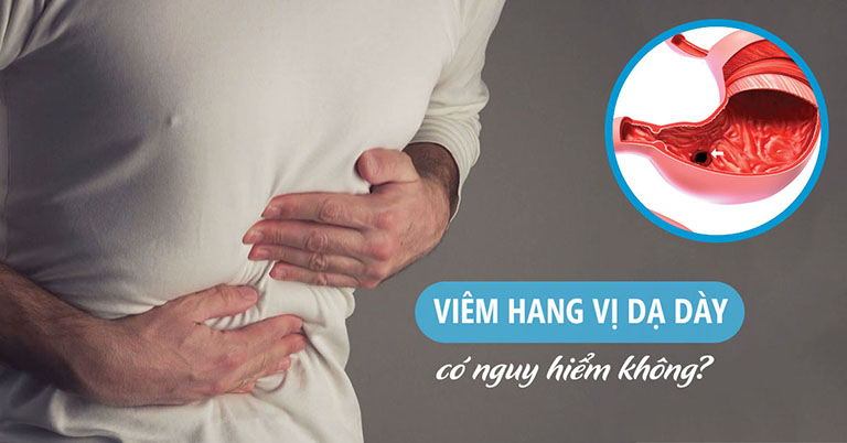 Viêm hang vị dạ dày có nguy hiểm không?