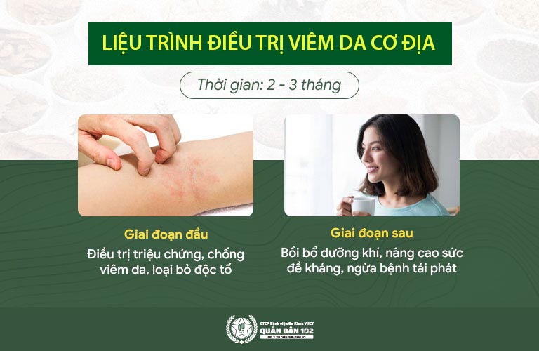 Liệu trình điều trị viêm da cơ địa quân dân 102