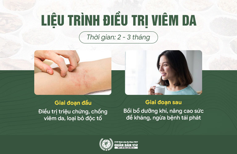 Liệu trình chữa viêm da tại Bệnh viện Quân dân 102